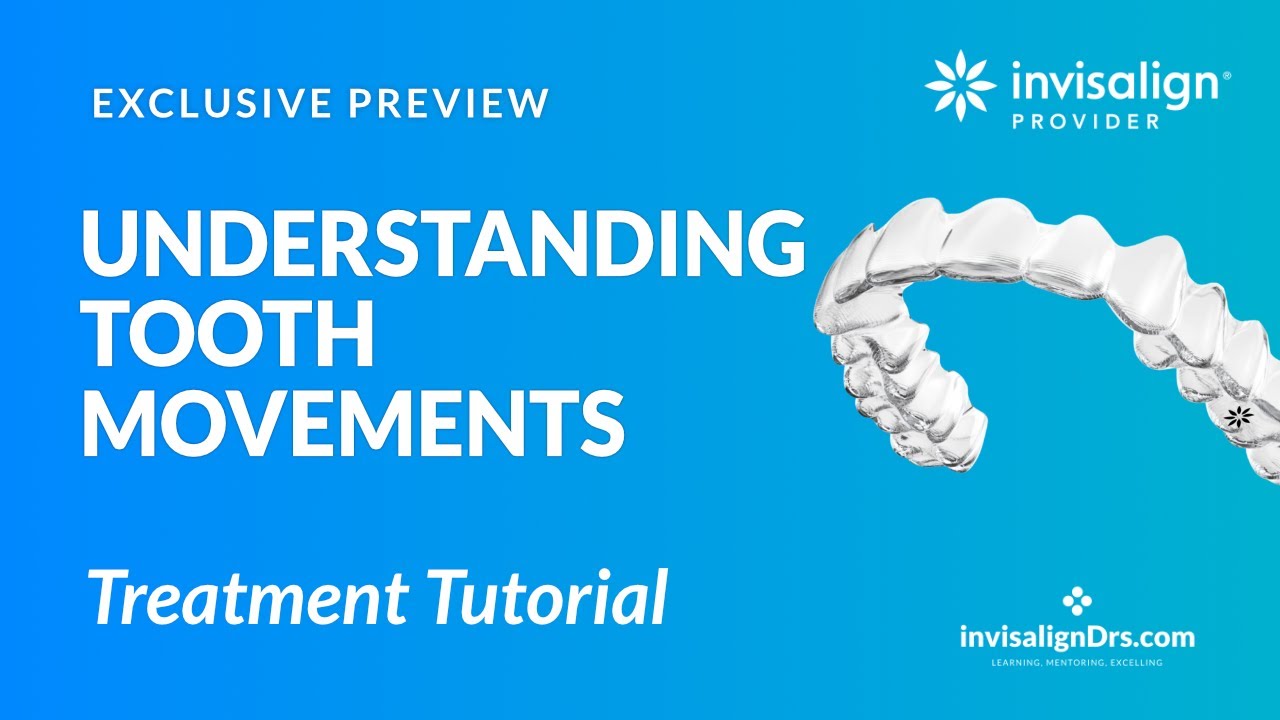 Understanding Invisalign Tooth Movements