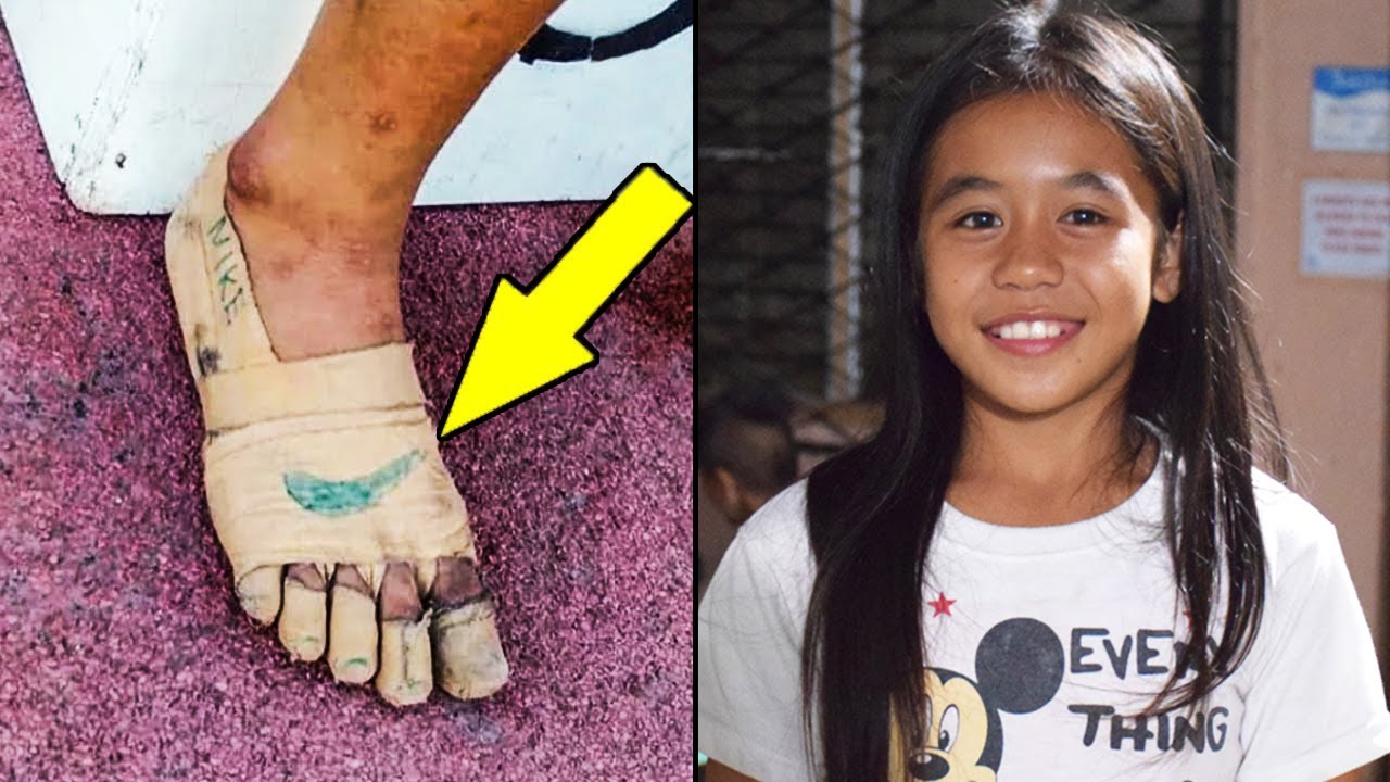 Kaikki pilkkasivat tätä köyhää tyttöä, sitten ihme tapahtui...