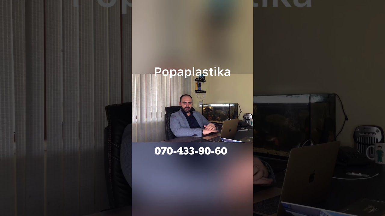 Popaplastika bakida-Dr.Mubariz Mammadli