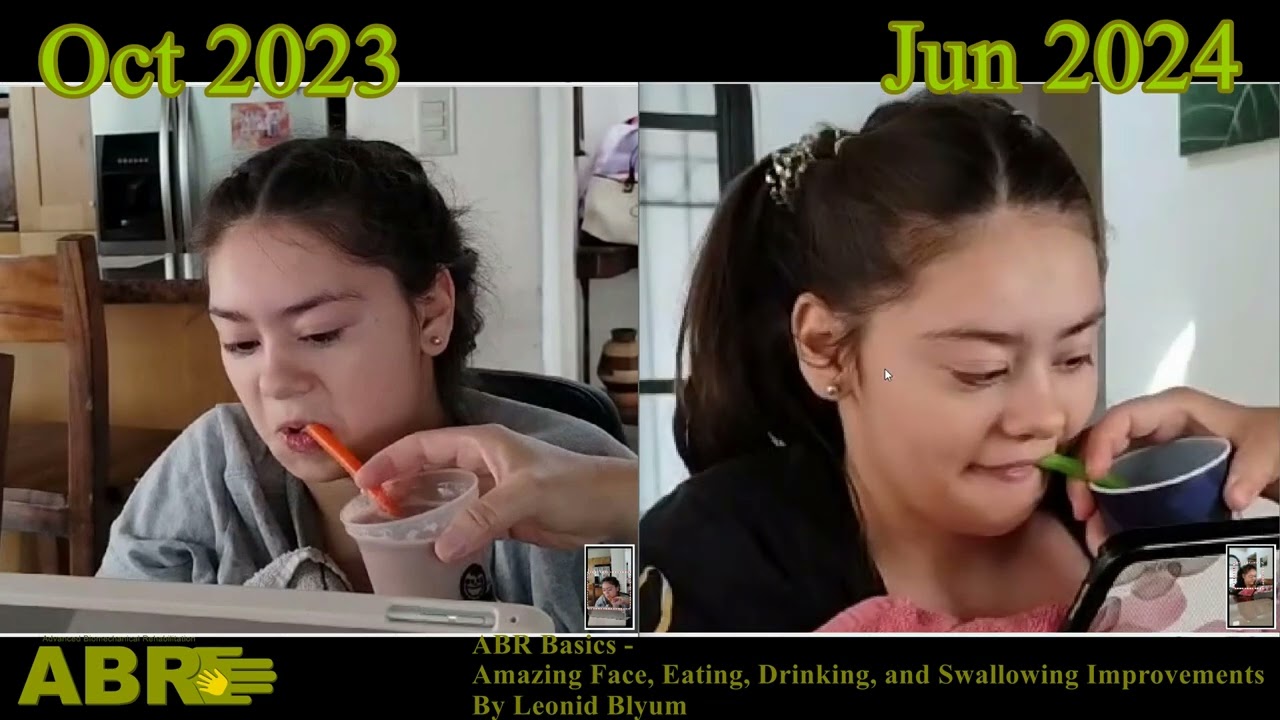 ABR Basics - Amazing Face, Eating, Drinking and Swallowing improvements.  By Leonid Blyum
