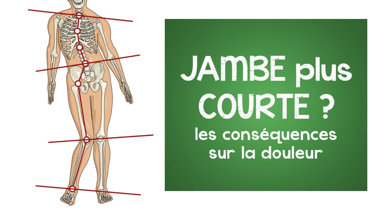 Jambe plus courte : les conséquences saisissantes sur la douleur