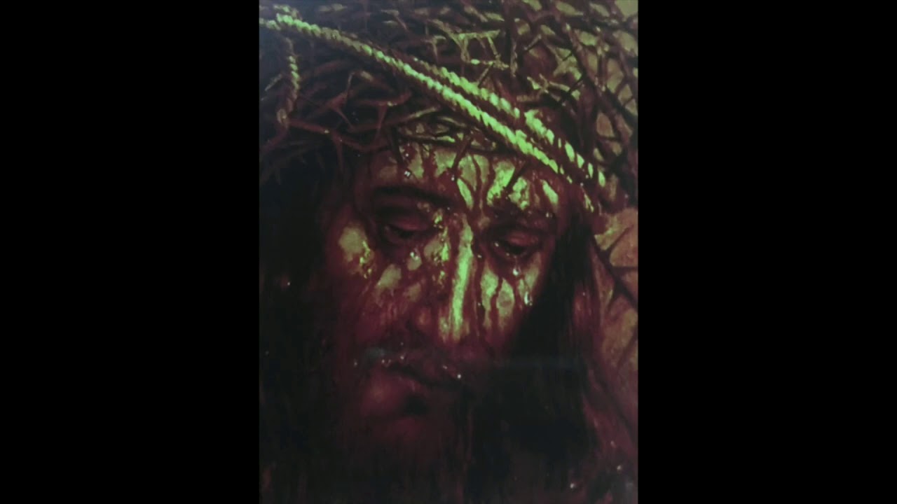 خمشي شرديه