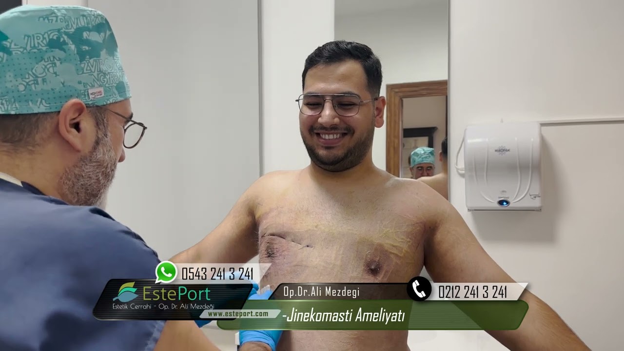 Jinekomasti Ameliyatından 3 ay Sonra İnanılmaz Değişim !!