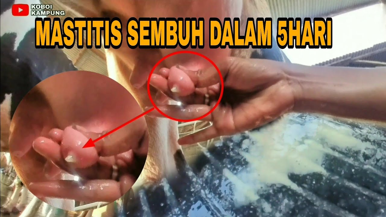 Cara Cepat dan Murah Mengatasi Mastitis