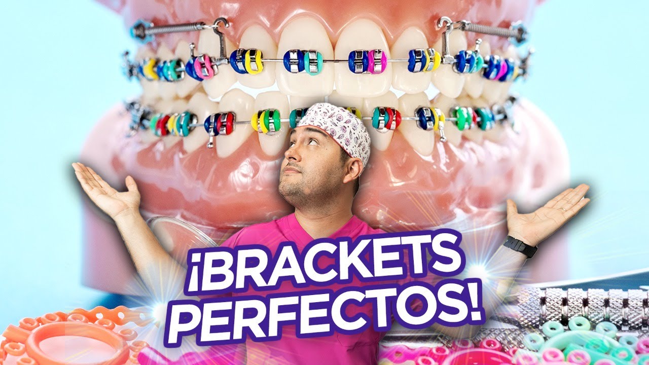 ✨COMO TENER TUS BRACKETS PERFECTOS ✨ ¡DURANTE el TRATAMIENTO DE ORTODONCIA en 2021❤️