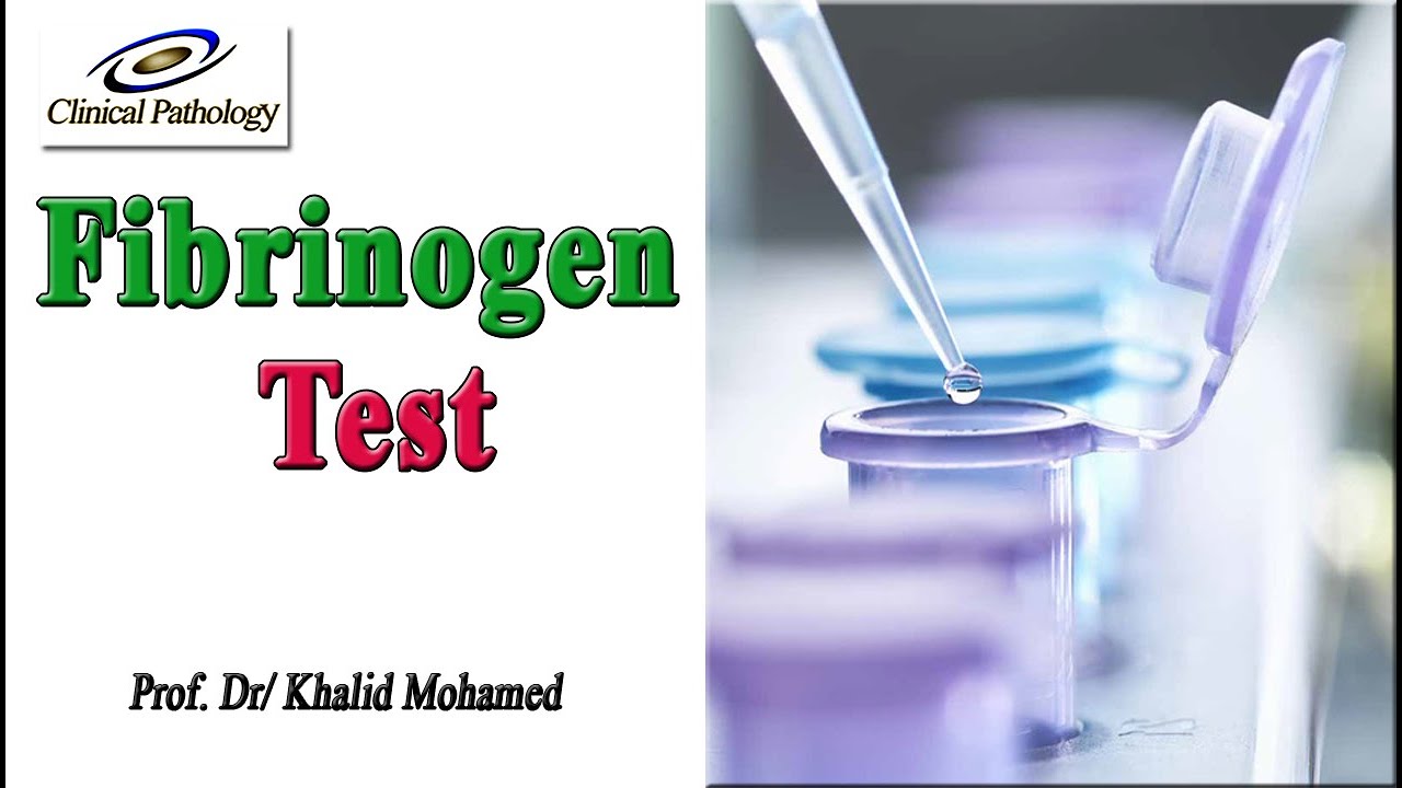 Fibrinogen Test:  MADE EASY