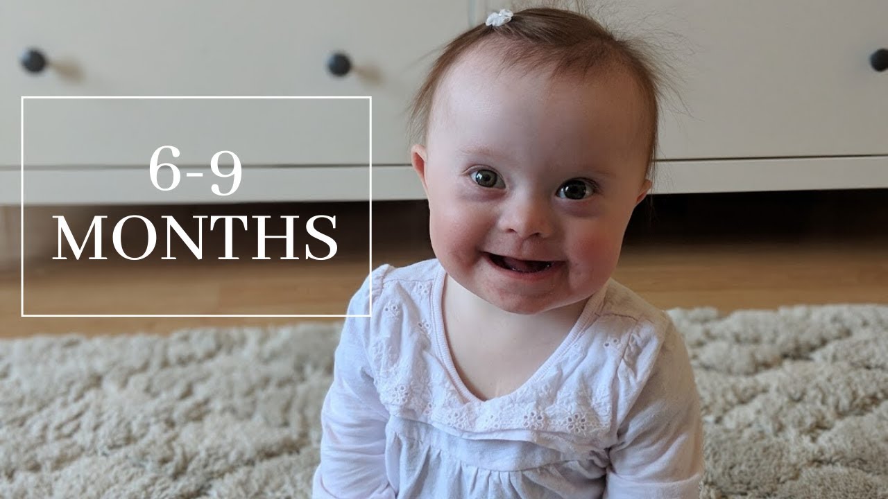 6-9 month old baby with Down Syndrome.