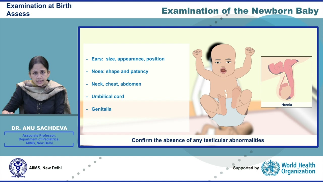 Examination of new born