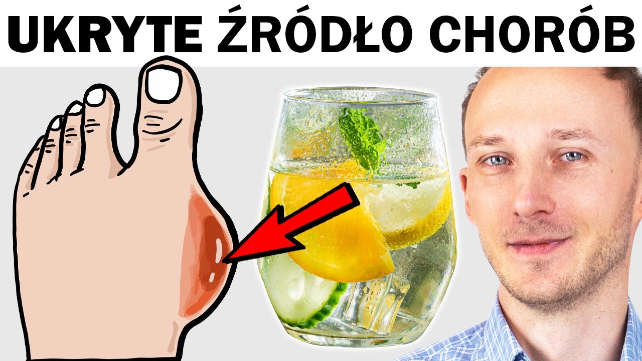 Powoli niszczy narządy. Wysoki kwas moczowy i jak go obniżyć