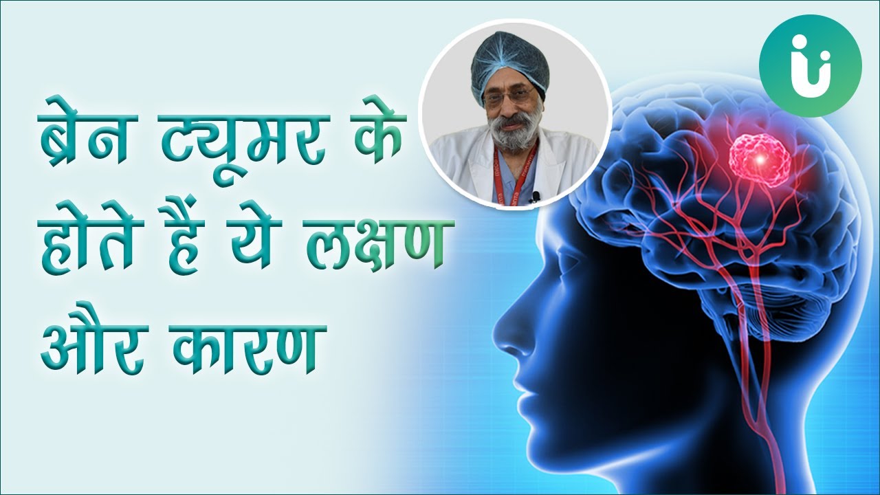 ये लक्षण दिखें तो हो सकता है ब्रेन ट्यूमर, Dr VP Singh से जानें ब्रेन ट्यूमर के लक्षण, कारण, प्रकार