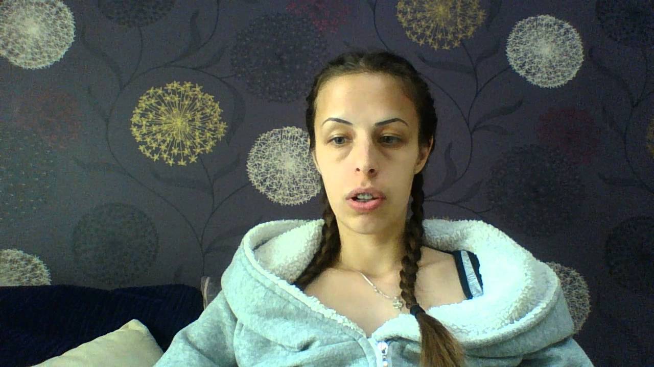 Брекети. Първа смяна на телчето + съвети за хигиената.
