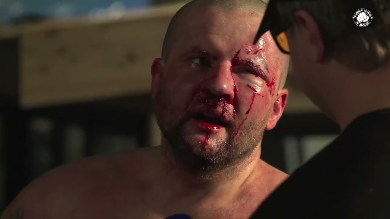 Watch FIGHT NIGHT 6 - Marcus vs Pawel (Bare Knuckle Boxing) BKB Bareknuckle fighting