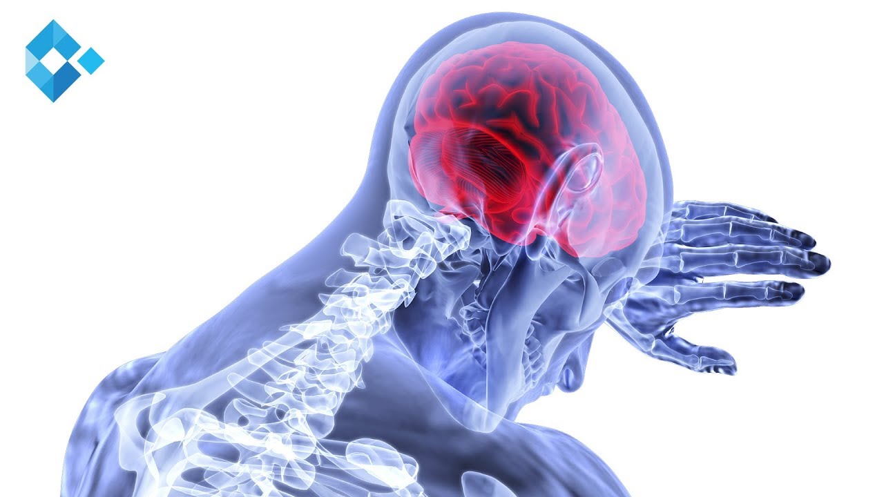 Schlaganfall erkennen & sofort handeln | Dr. Gattringer