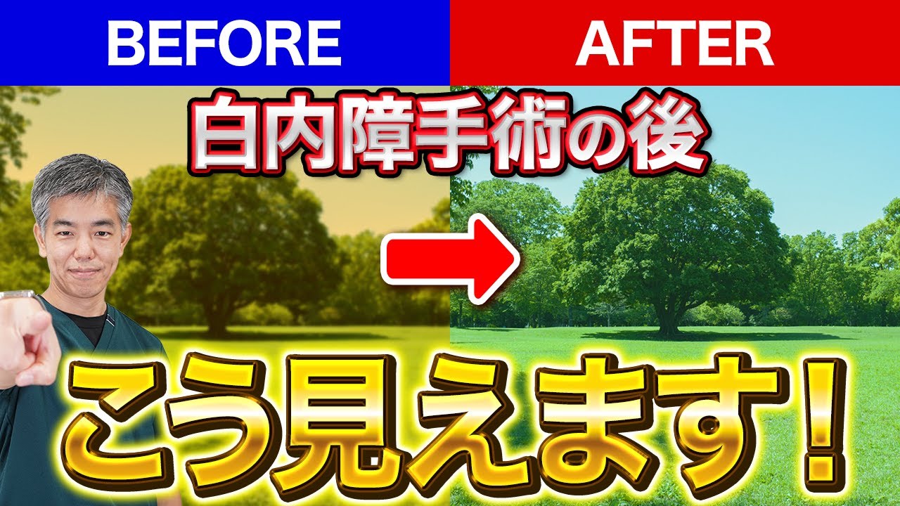白内障手術後の視力はどこまで回復する？実際の見え方と“よくある誤解”
