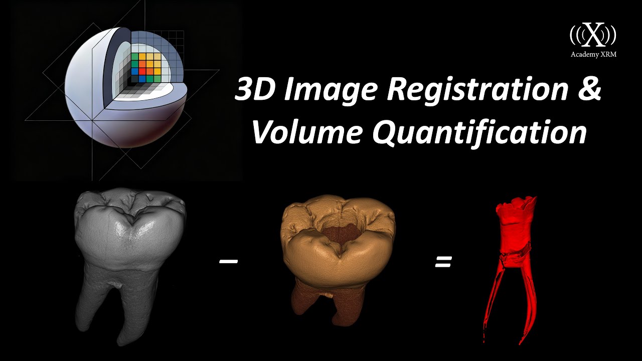3D Slicer Tutorial: From 3D Image Registration to Volume Difference Quanitification