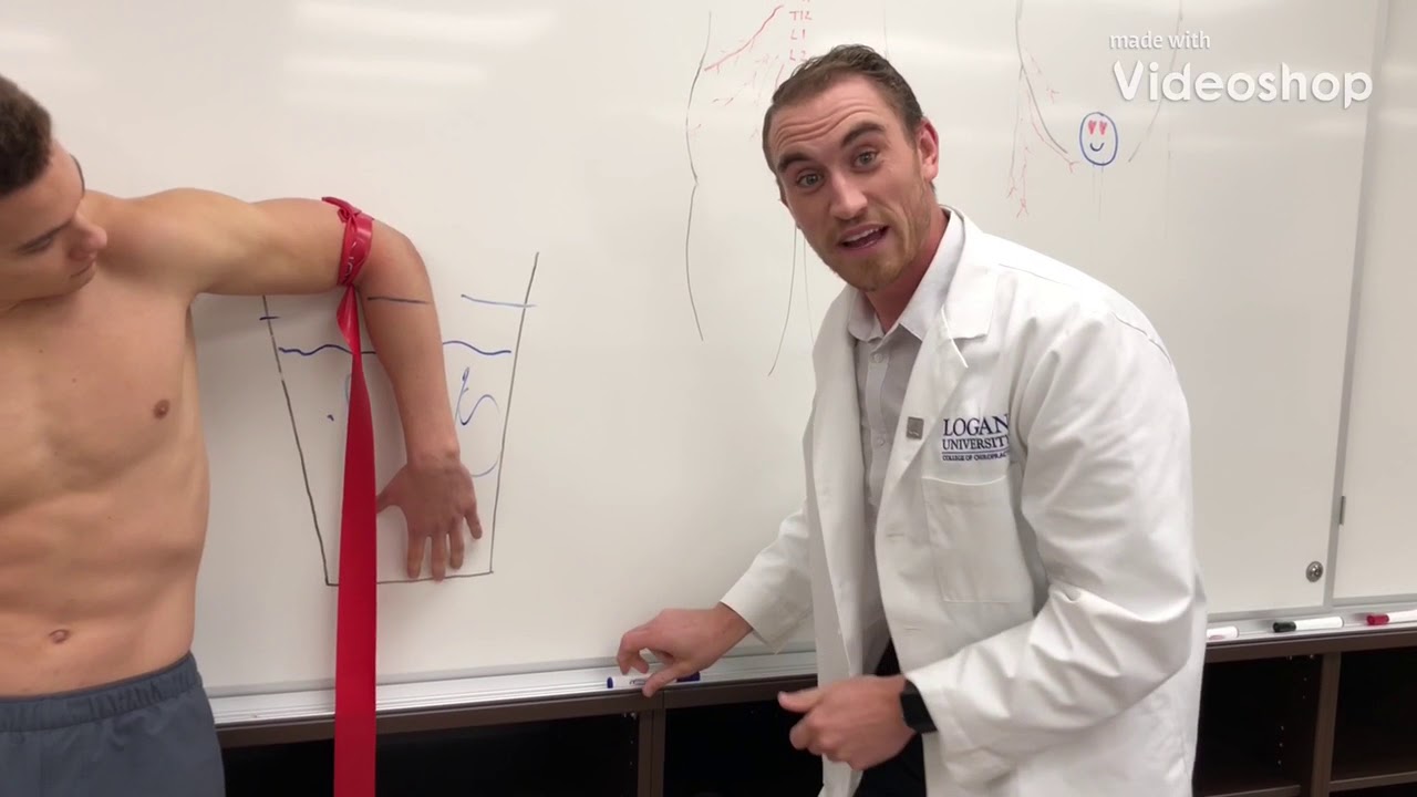 Cluneal Nerve Entrapment