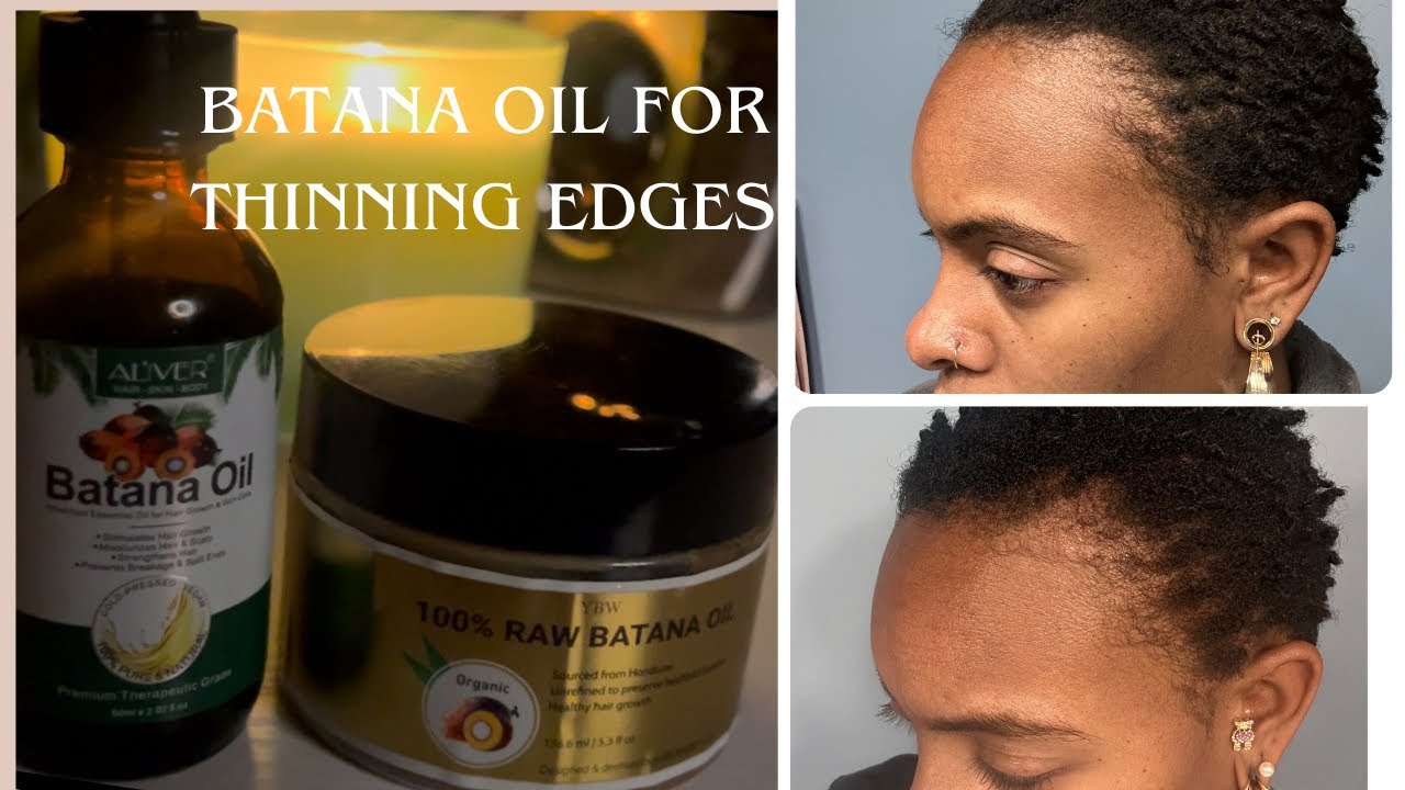 Regrow Your Edges with Batana Oil | My Honest Experience