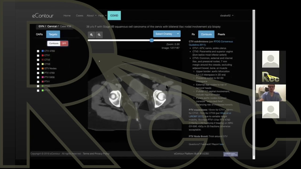2D to 3D EBRT | Session 13 | Contouring Training Cases with ProKnow: Cervical Cancer