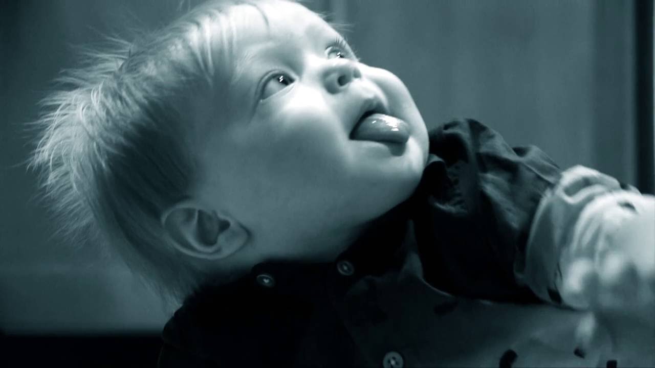 Iron Deficiency Dangers in Children