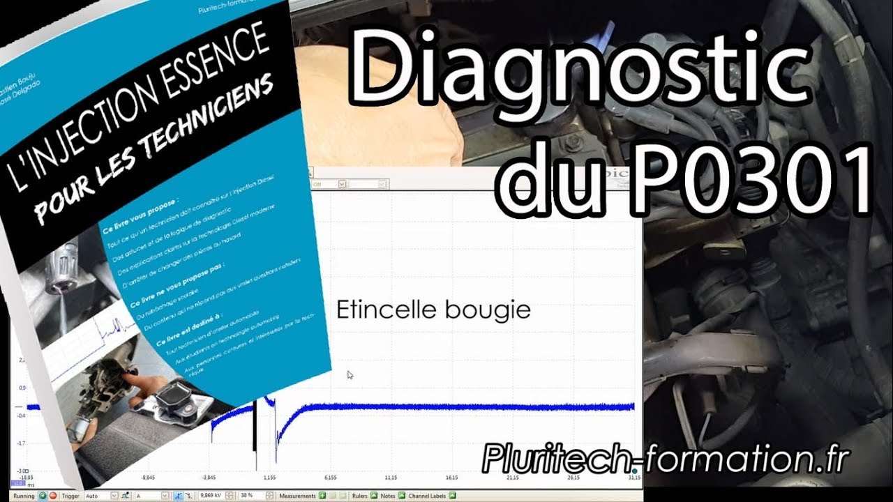 Diagnostic P0301 / Problème d'allumage, compression ou injection ?