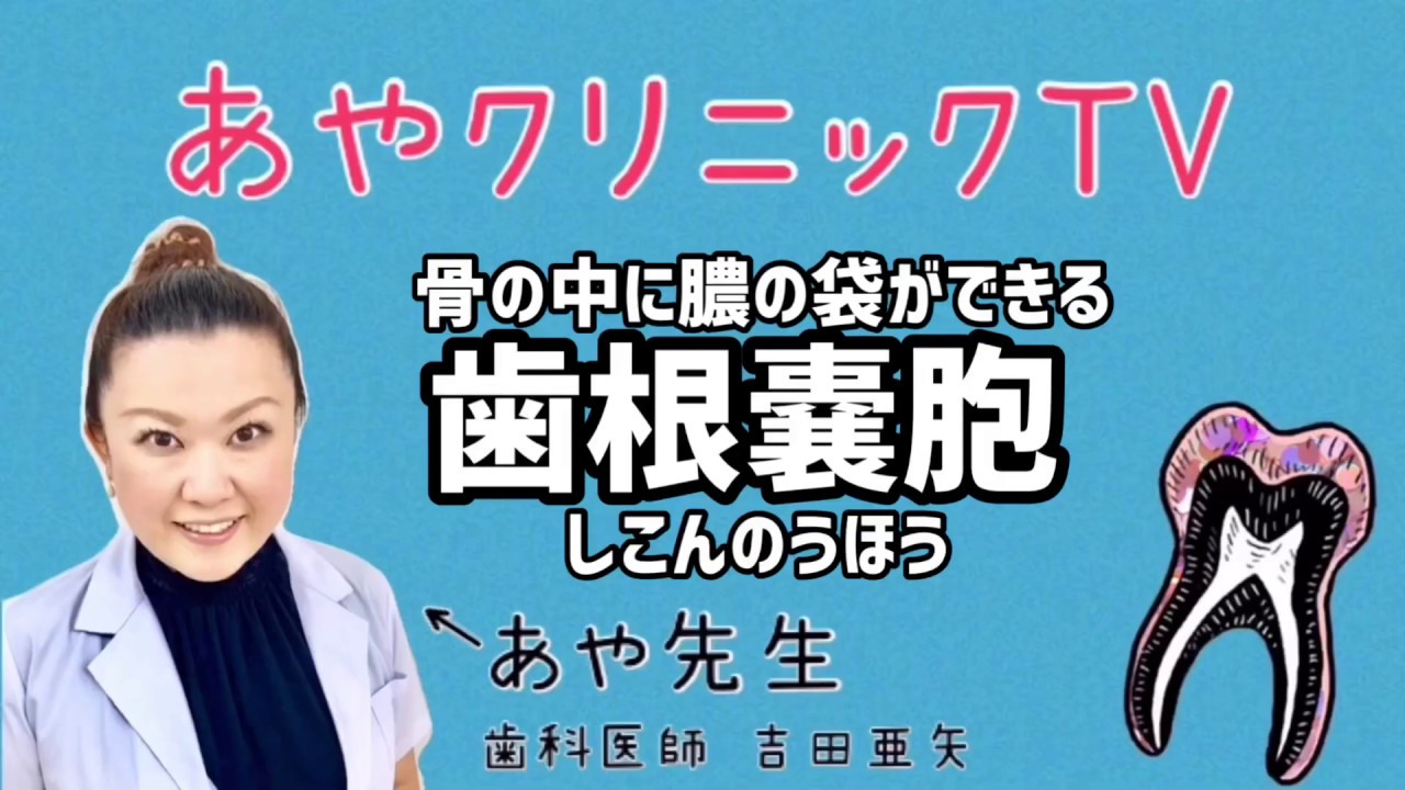 骨の中に膿の袋ができる歯根嚢胞#4