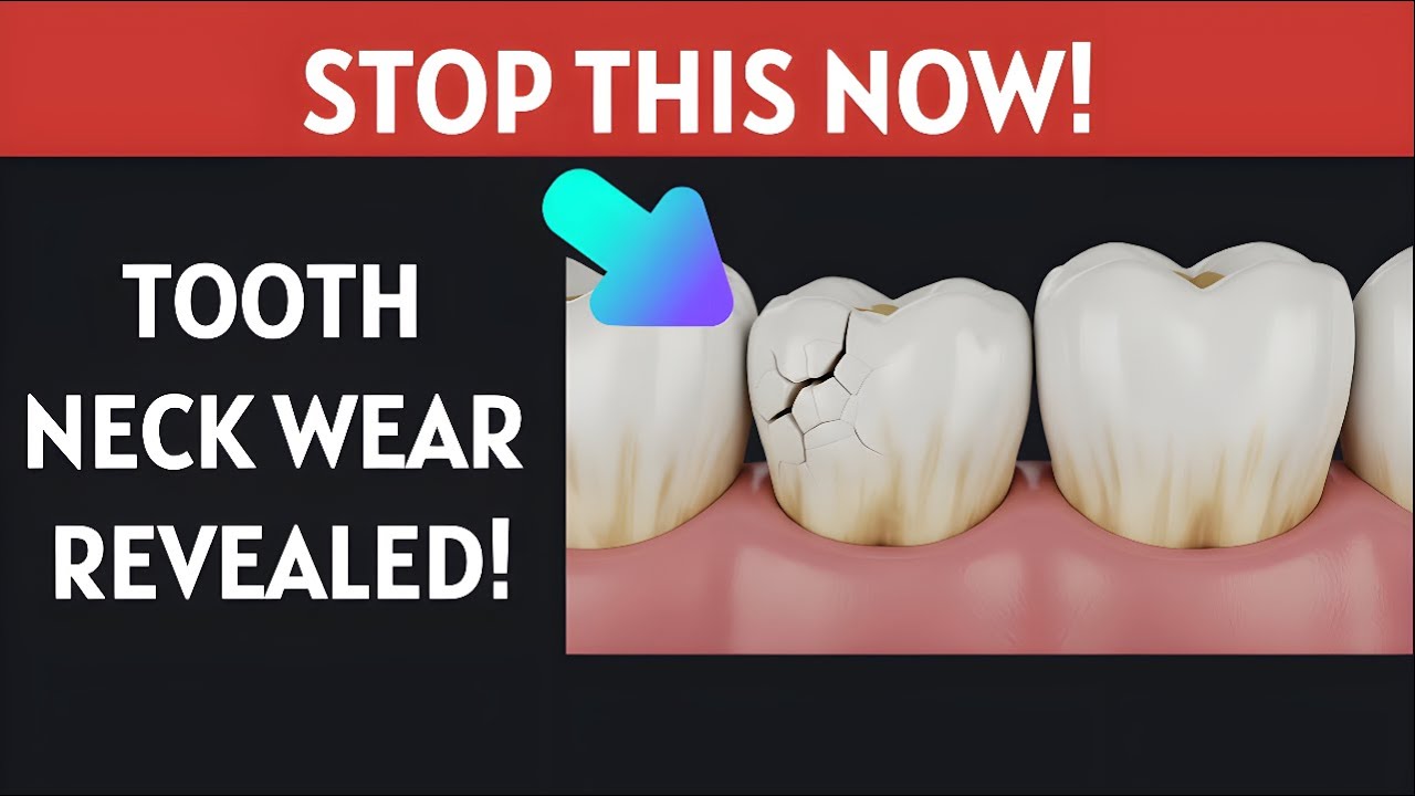 3 PROVEN Ways to Stop Tooth Neck Wear — Dentist Explains