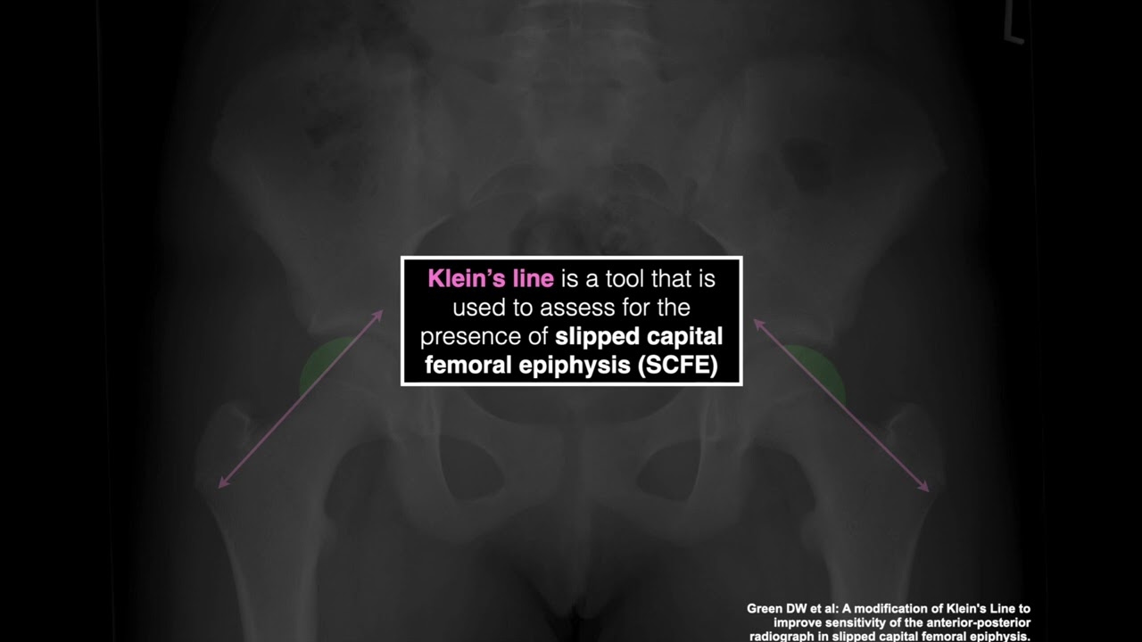 MSK Radiology series - Part 7