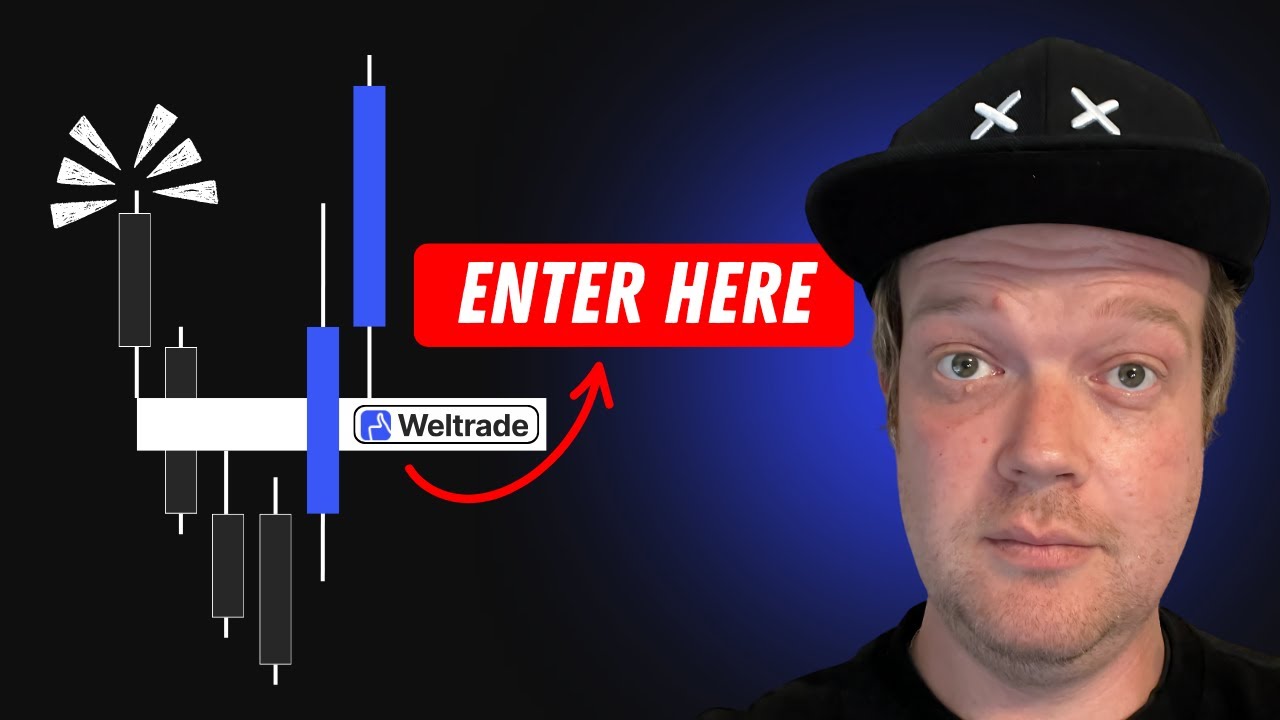 How to Trade Pain and Gain | Weltrade