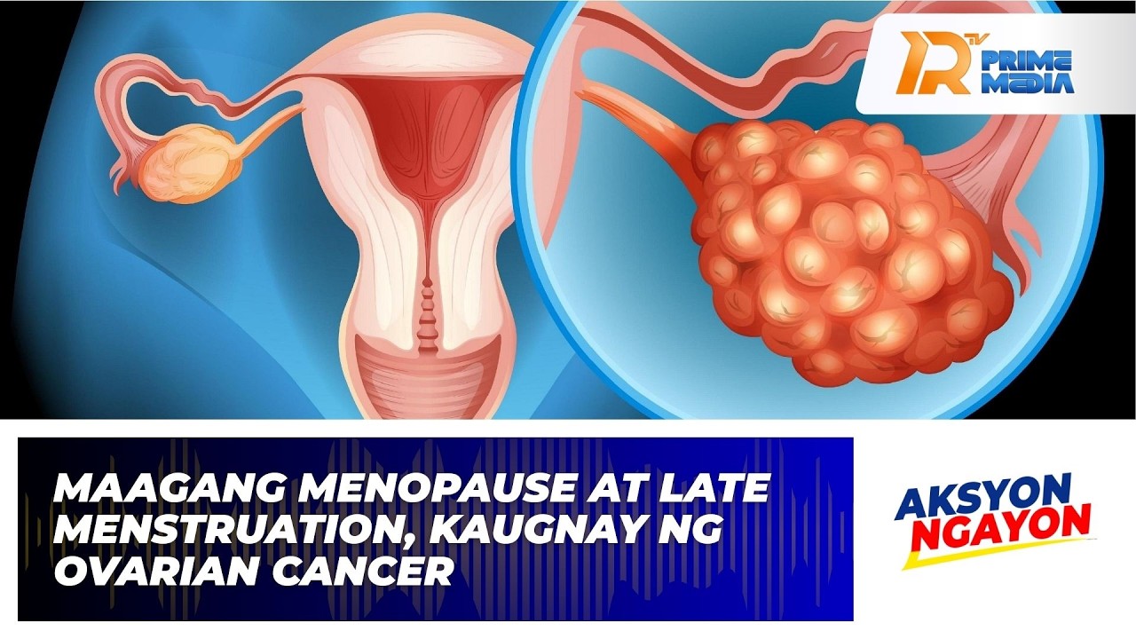 Maagang Menopause at Late Menstruation, Kaugnay ng Ovarian Cancer | Aksyon Ngayon