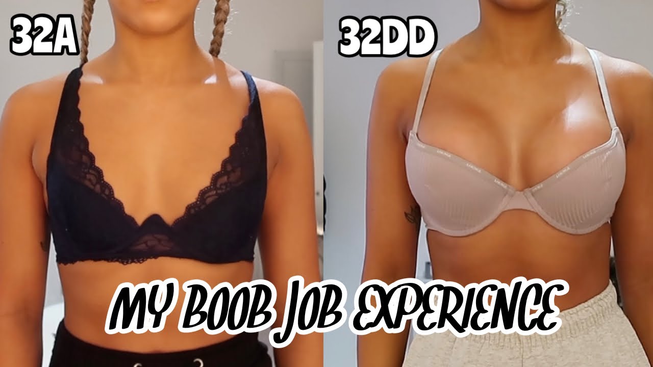 My Boob Job Vlog