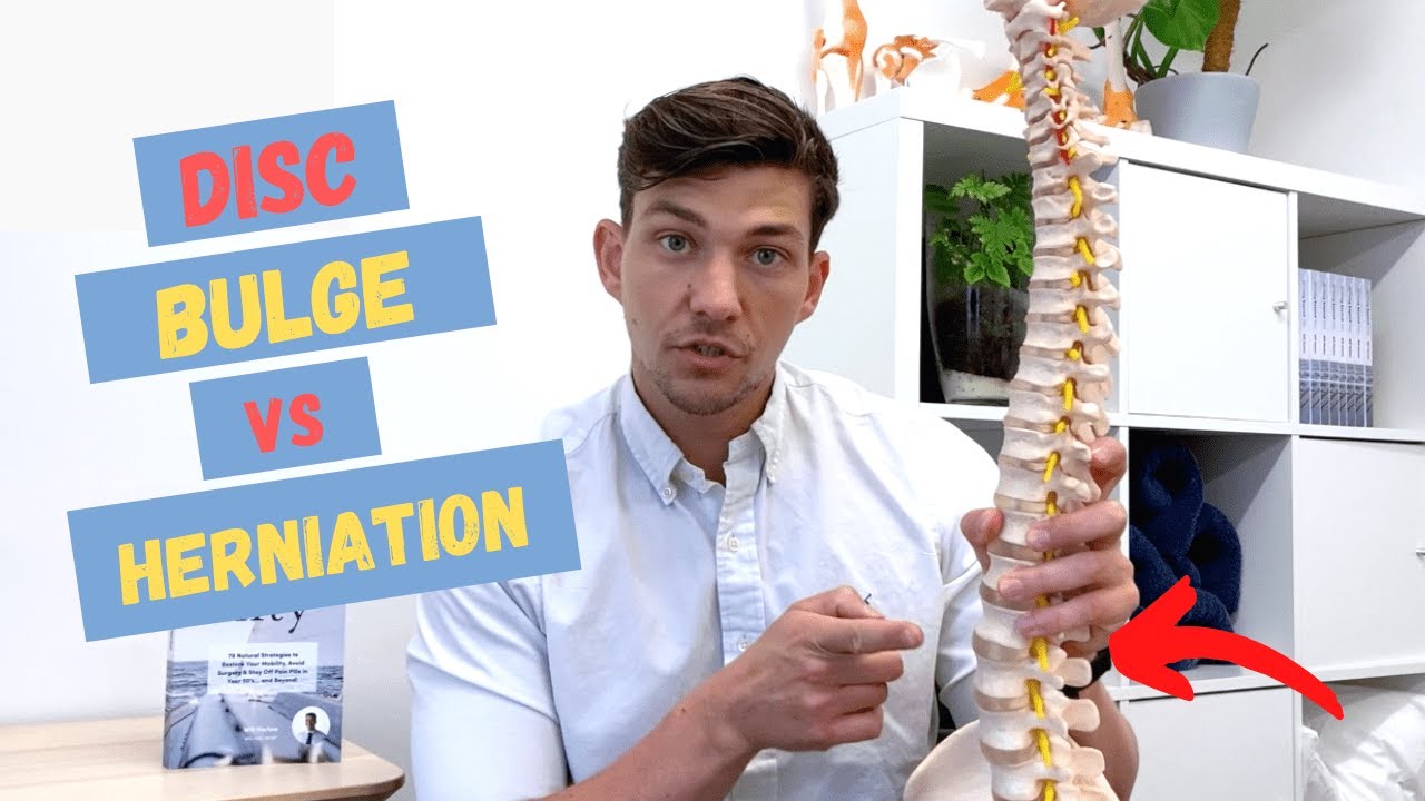 Bulging Disc vs Herniated Disc &ndash;&nbsp;What's the Difference?