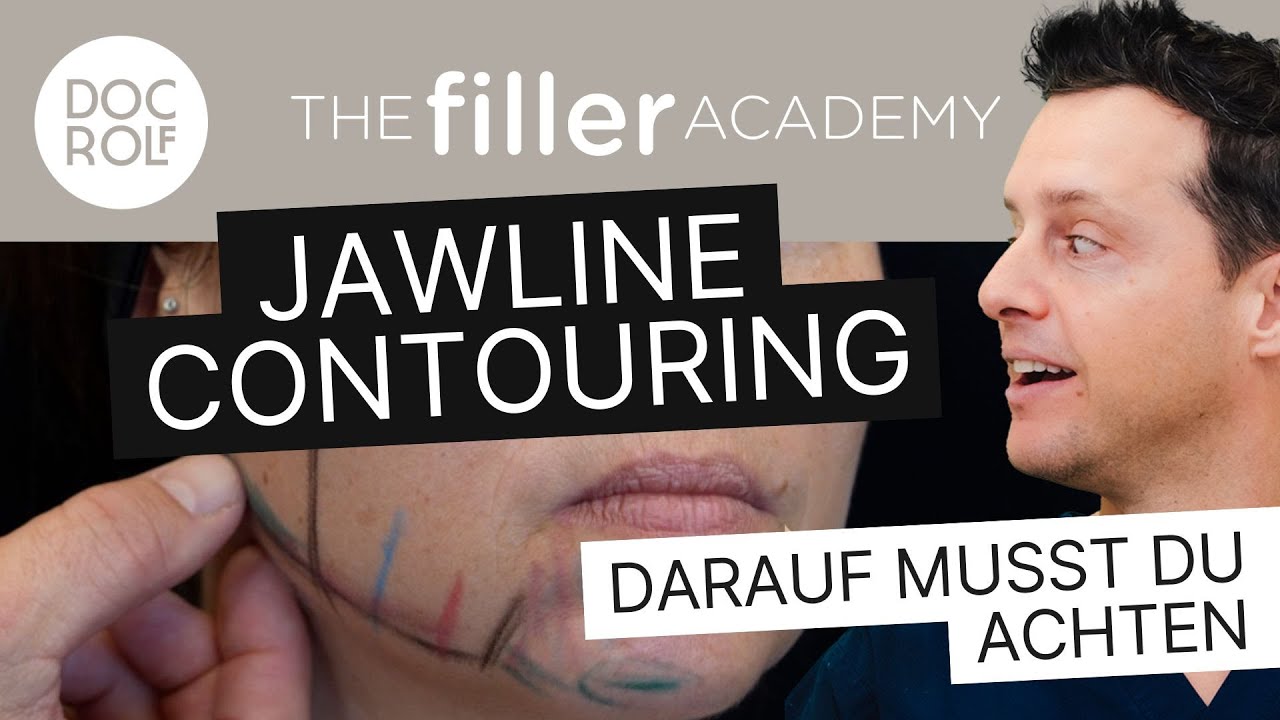 JAWLINE CONTOURING: Unterspritzung mit Hyaluron, so geht's richtig &ndash; TFA by doc.rolf