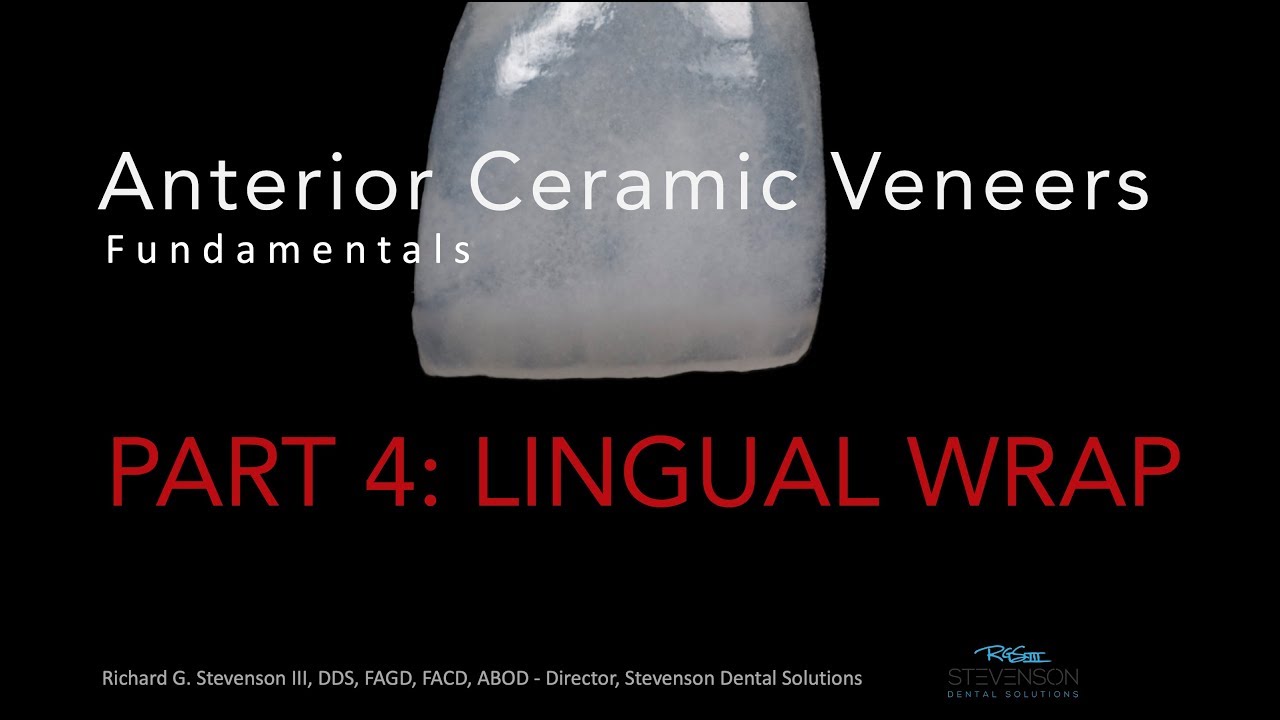 Anterior Ceramic Veneers, Part 4:  Lingual Wrap