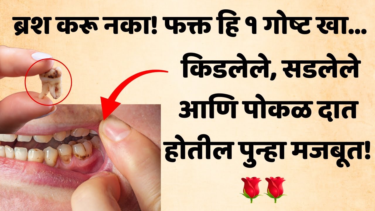 ब्रश करू नका! फक्त हि १ गोष्ट खा… किडलेले, सडलेले आणि पोकळ दात होतील पुन्हा मजबूत!