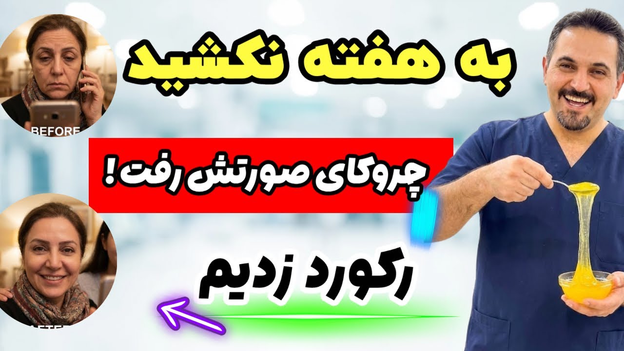 یک ترکیب ضد پیری برای رفع فوری چروک صورت