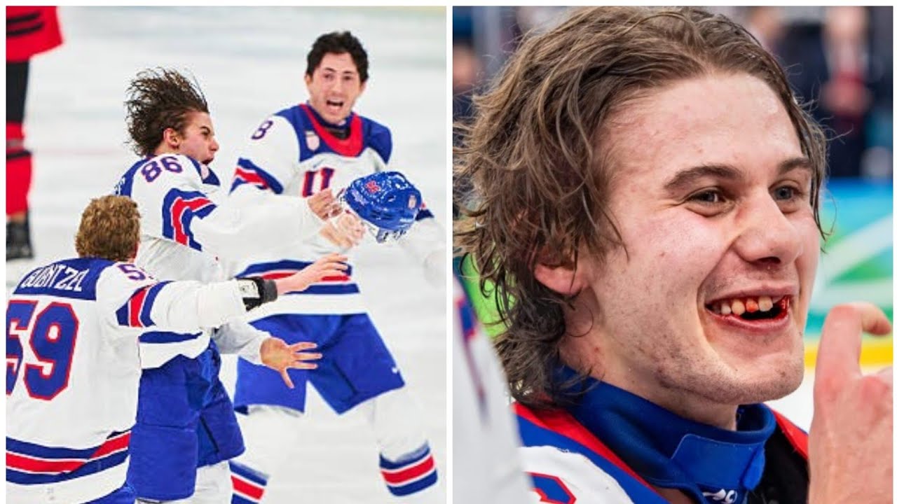 Jack Hughes lost teeth from a high-stick to the mouth before his Olympic gold-winning goal
