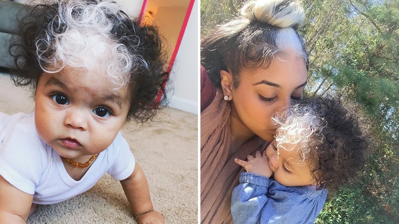 Baby Born With Unique White Streak Through Hair Just Like Her Mom