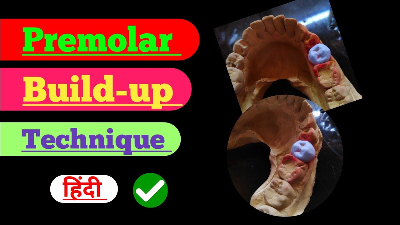 Premolar Build up| Ceramic porcelain| ceramic| Anatomy| dental technician| Laboratory| | build up