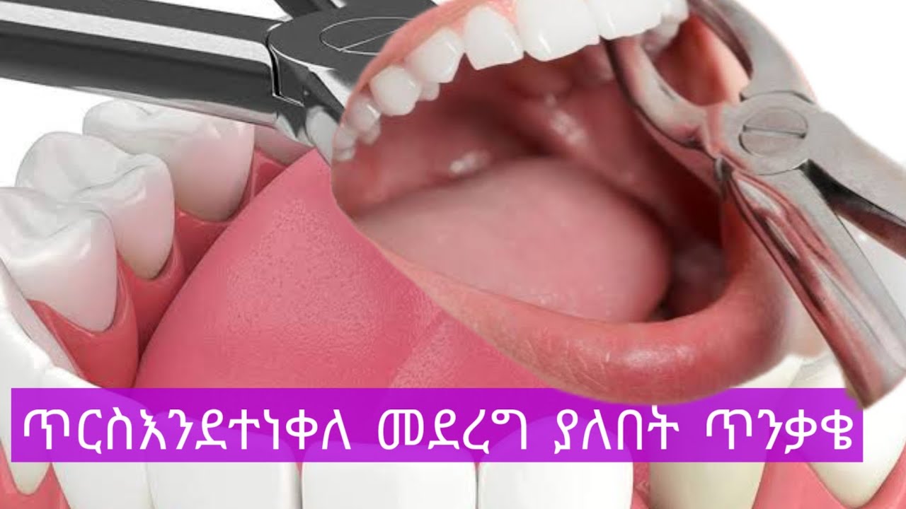 ጥርስችሁን ከተነቀላችሁ በሗላ መደረግ ያለበት ነገር/ለጥንቃቄ
