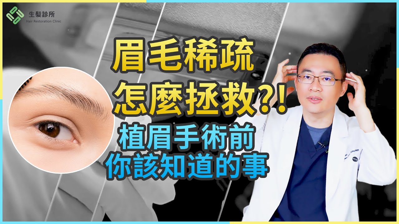 植眉QA大公開：改變氣質的關鍵是眉毛？(上集)｜生髮植髮專家朱冠州院長