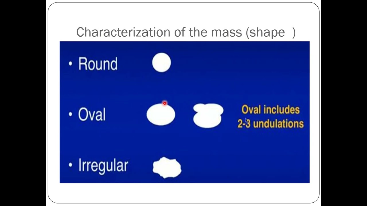 Breast MRI part III