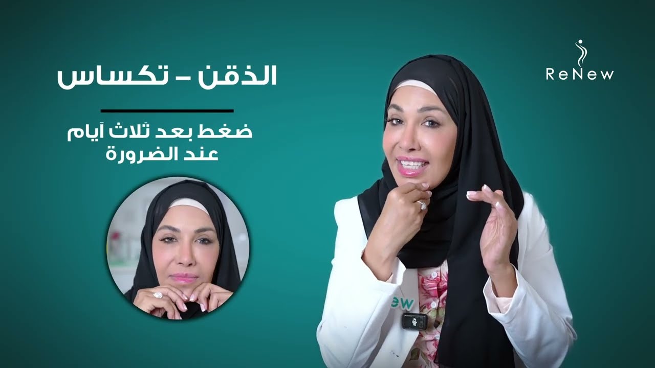 تعليمات مهمة بعد حقن الفيلر للحصول على أفضل نتيجة