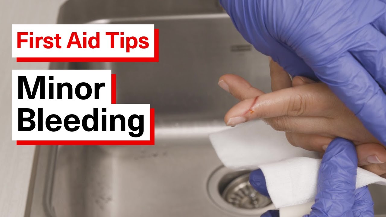 How to Help Someone with Minor Bleeding | First Aid Tips