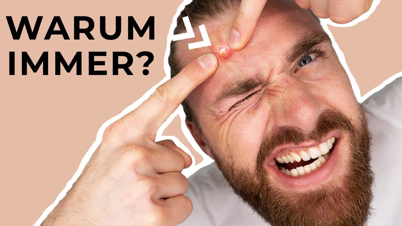 Darum bekommst du immer wieder Pickel ● Hautpflegetipps für Männer