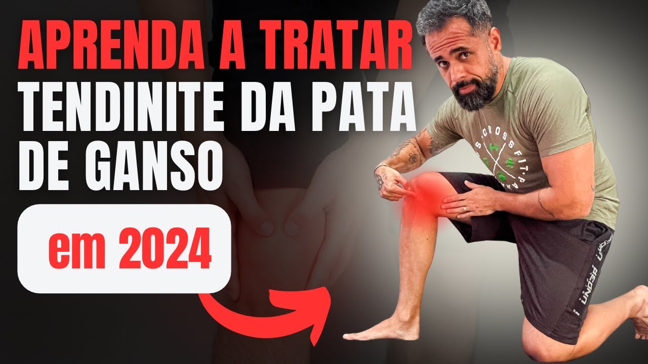 🚨[INCRÍVEL]🚨COMO TRATAR A TENDINITE DA PATA DE GANDO EM 2024