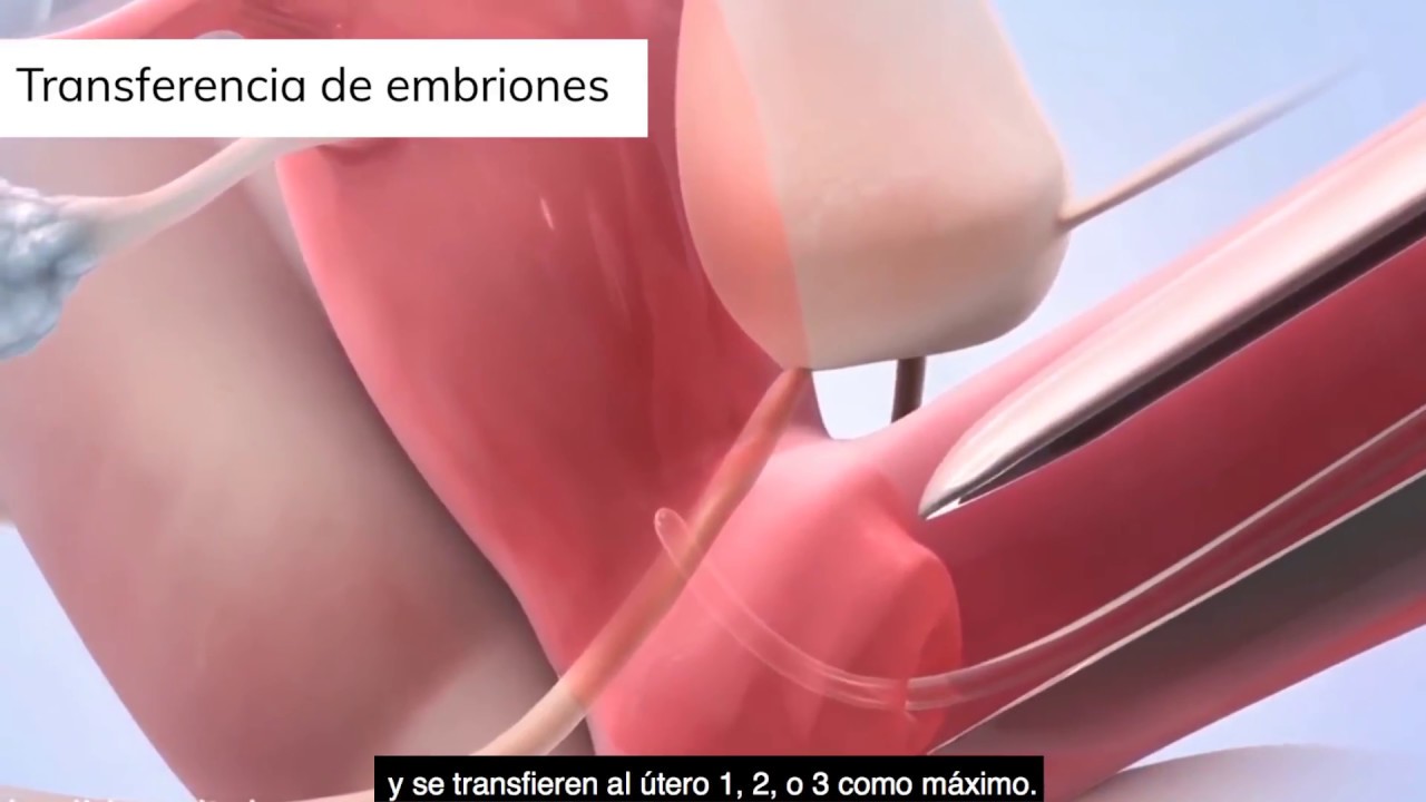 Conoce de la mano de la Dra. Ochoa como se realiza un tratamiento en CER Santander