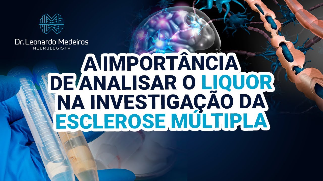 A importância de analisar o liquor na investigação da Esclerose Múltipla