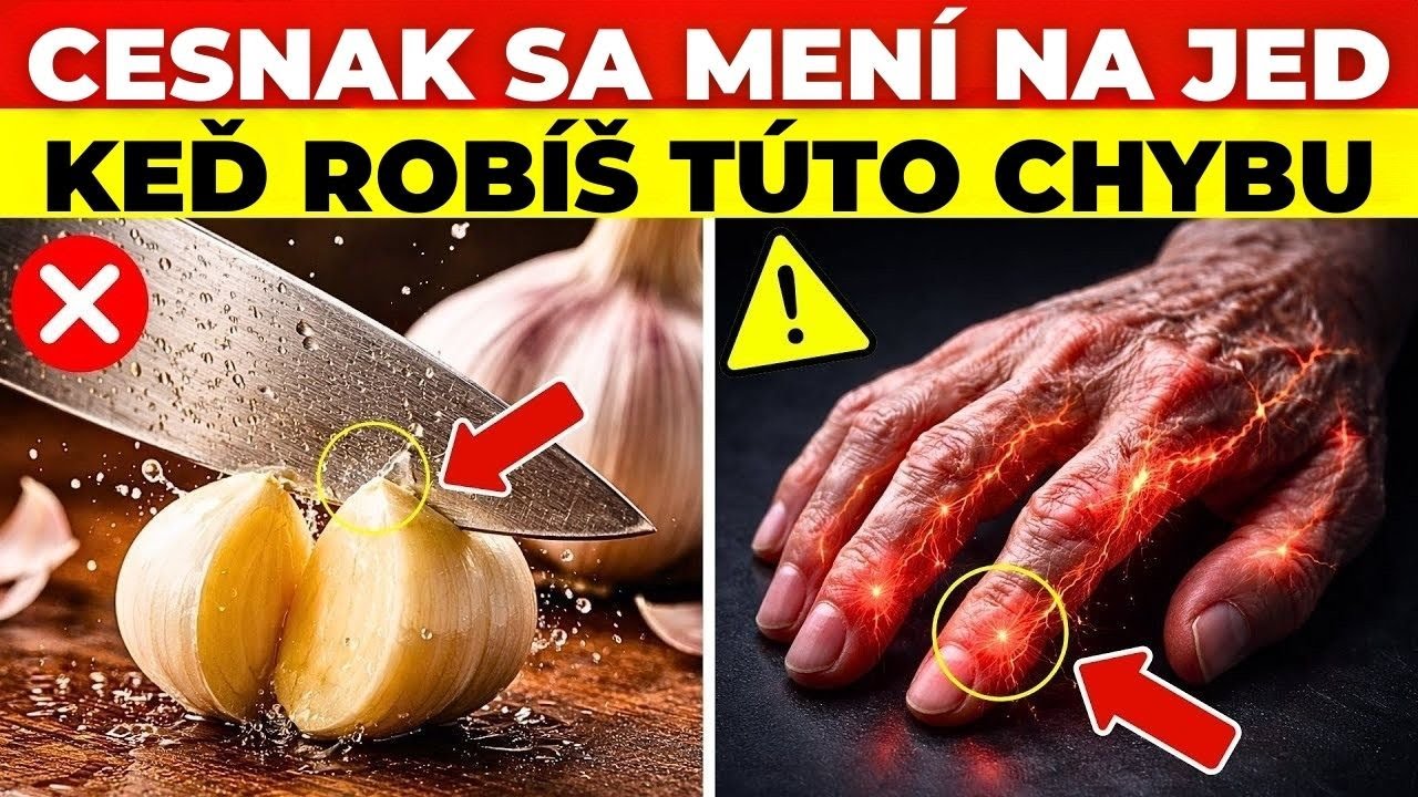 CESNAK SA MENÍ NA JED: 10 CHÝB, KTORÉ ROBÍ 90 % ĽUDÍ | SilníaZdraví