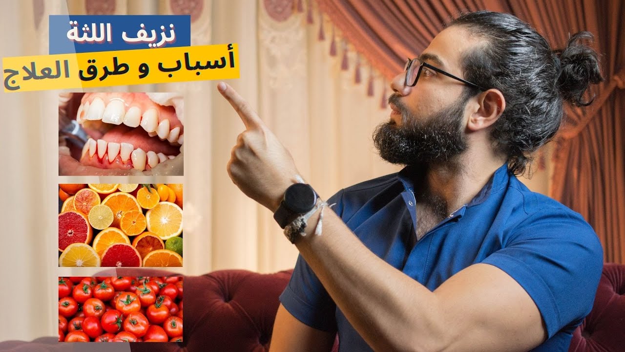مضمضة - نزيف اللثة