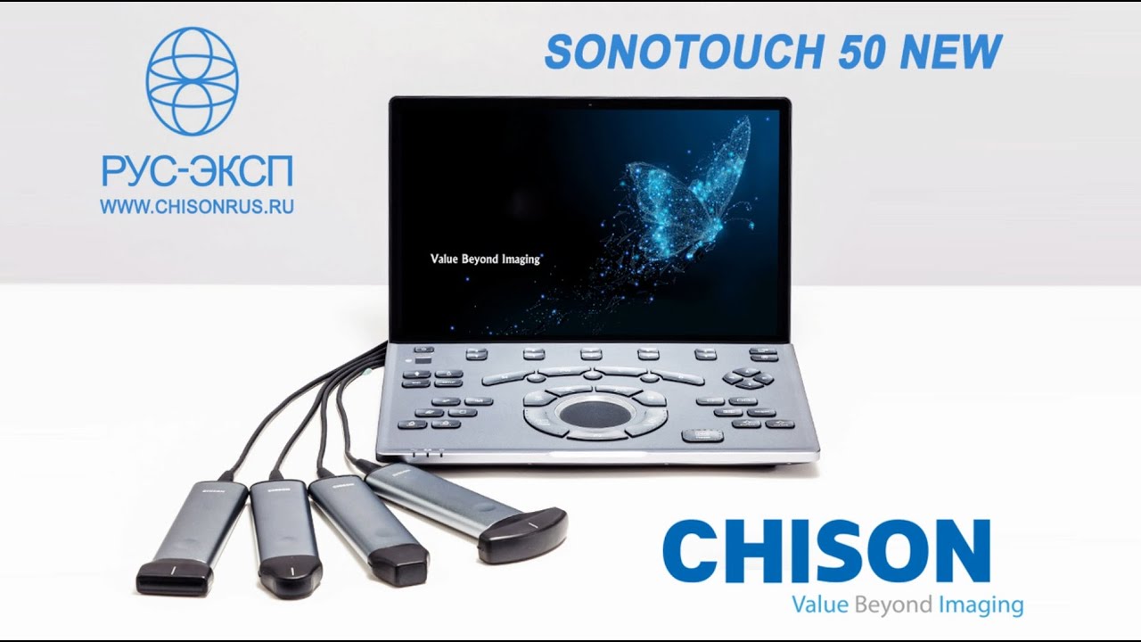 Переносной УЗИ CHISON SONOTOUCH 50 (Sonoair) ультрабук